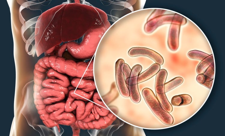 which diseases caused by bacteria? cholera