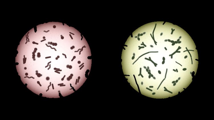 bacterial classification by gram staining